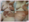 Breast Cancer-Essentials-Fig1.4
